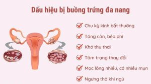 Buồng trứng đa nang – Cơ hội nào mang thai tự nhiên cho chị em?