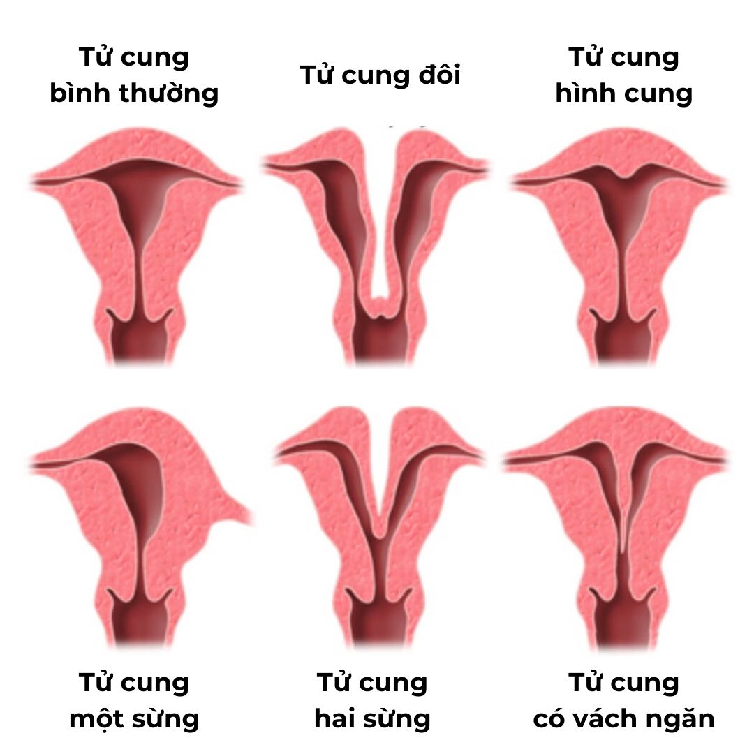 Các bất thường thường gặp 