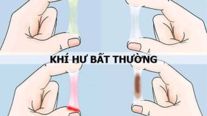 Khi xuất hiện khí hư bất thường, bệnh nhân nên đến các phòng khám Sản phụ khoa uy tín