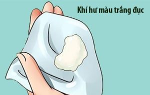 Ra khí hư màu trắng đục như bột: Lời khuyên từ bác sĩ