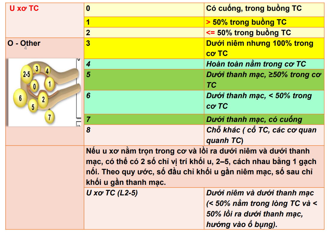 Phân loại u xơ tử cung theo FIGO 2011