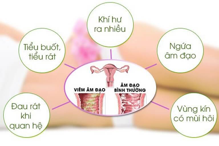 Các triệu chứng của nấm Candida âm đạo có thể dễ dàng nhận thấy