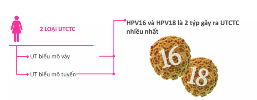 HPV16 và HPV18 - 2 thể là nguyên nhân gây ung thư cổ tử cung phổ biến nhất