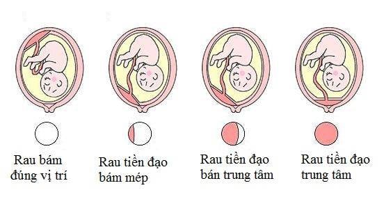 Vị trí của rau tiền đạo