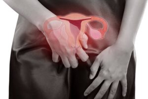 Lộ tuyến cổ tử cung có cần phải điều trị sớm?