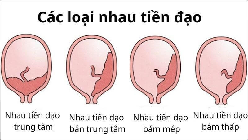 Một số vị trí rau tiền đạo thường gặp