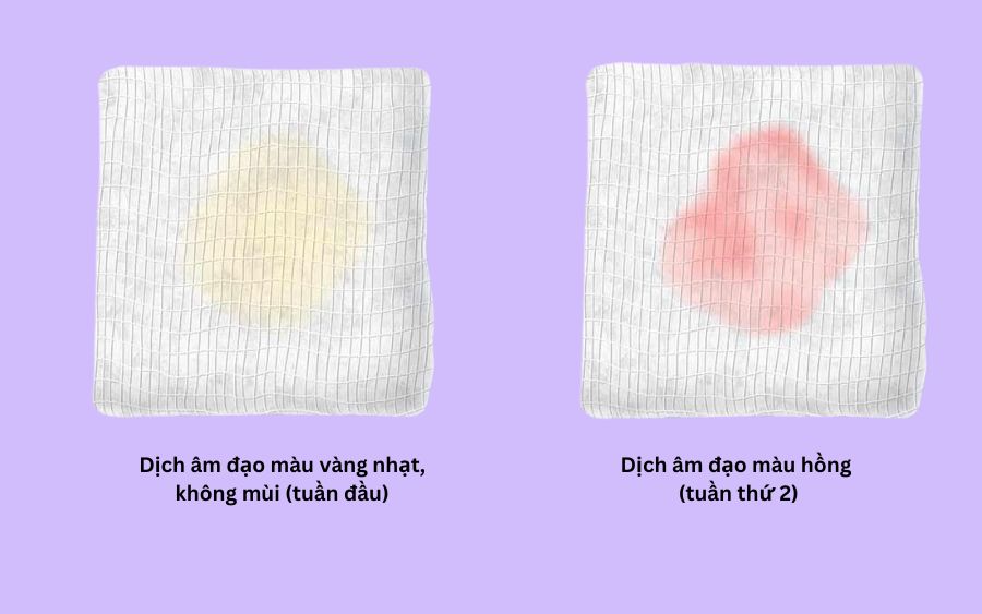 Sau khi đốt viêm lộ tuyến bị ra máu nhiều xử lý như thế nào? 3 Sau khi đốt viêm lộ tuyến bị ra máu nhiều
