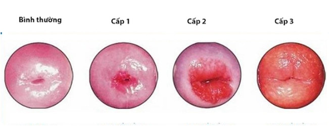 7. Các Câu Hỏi Thường Gặp Khi Đốt Viêm Lộ Tuyến