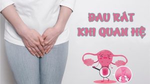 Quan hệ xong bị đau rát có sao không ?