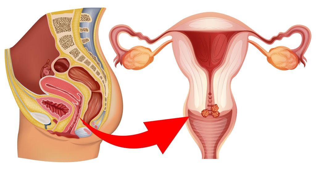 4. Quy trình và những điều cần kiêng trước và sau khi tiêm HPV