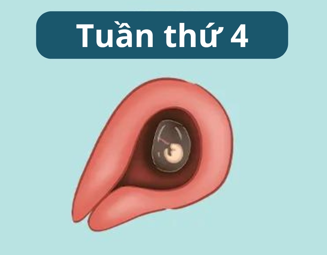 Minh họa phôi thai khi bụng bầu 1 tháng