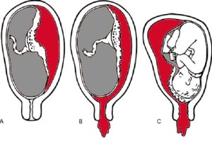 Rau tiền đạo là gì?