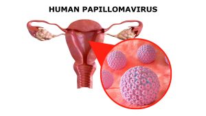 Tiêm HPV rồi cần sàng lọc ung thư cổ tử cung không?