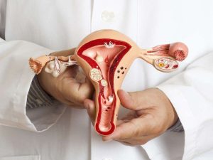 Tìm hiểu kết quả tầm soát ung thư cổ tử cung