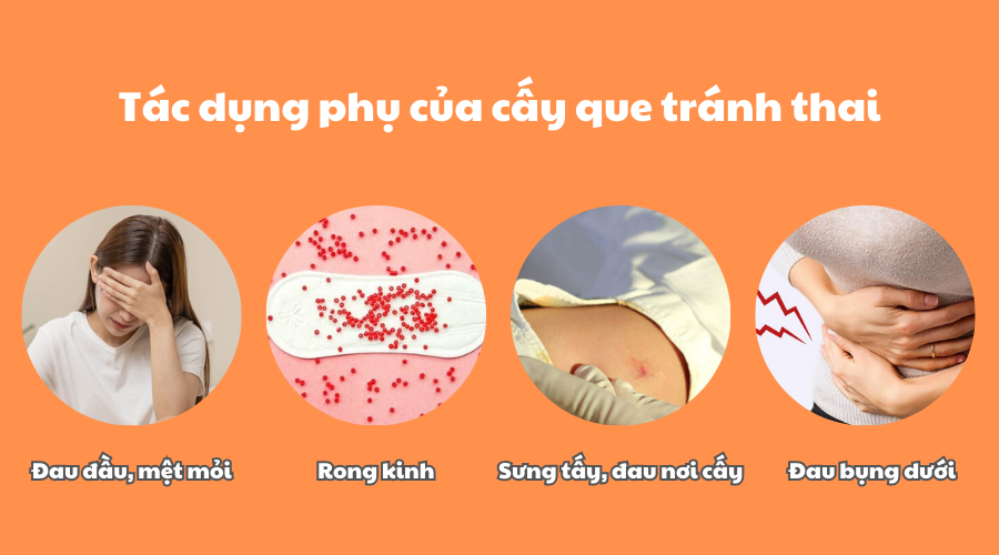 Tác dụng phụ của cấy que tránh thai 