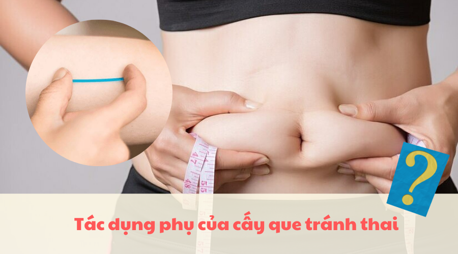 Cấy que tránh thai có thể gây ra tình trạng tăng cân