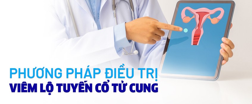 Phương pháp chữa bệnh ảnh hưởng chi phí điều trị viêm lộ tuyến cổ tử cung 