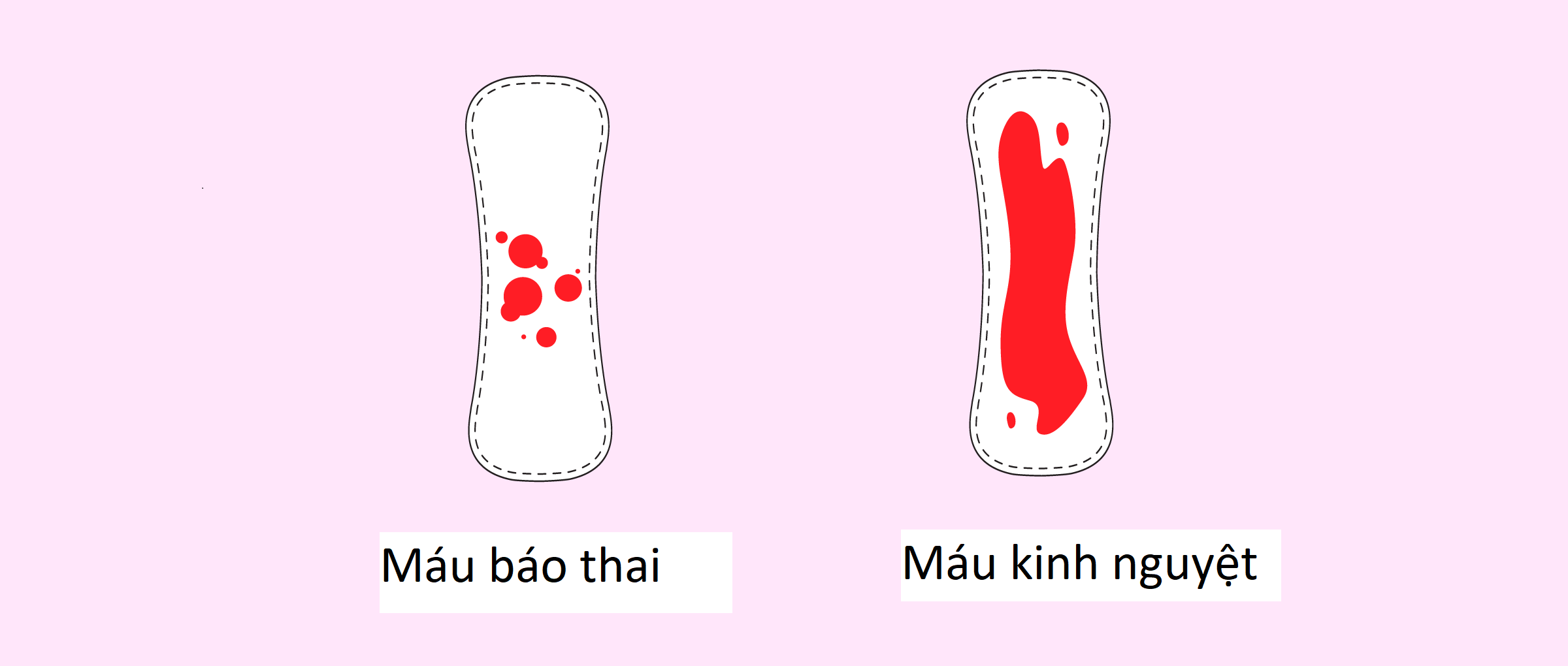 Lượng máu báo thai khi trễ kinh thường ít và có màu nhạt hơn so với máu kinh nguyệt