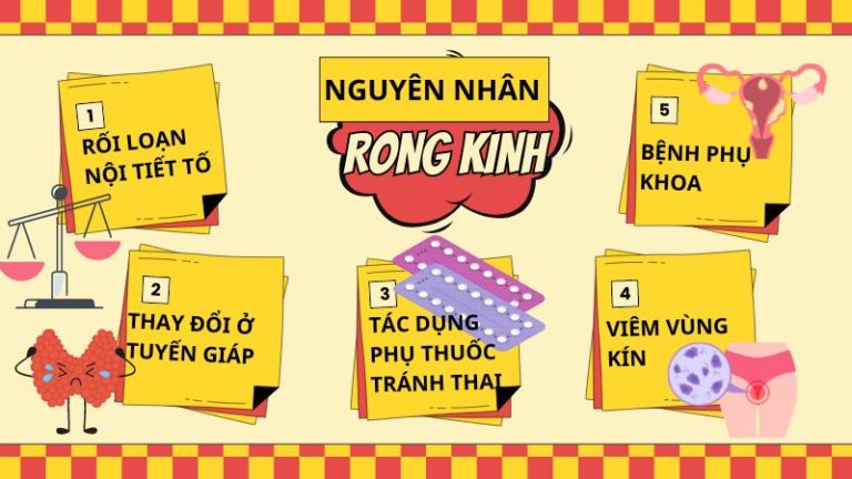 Rong kinh 20 ngày do nhiều nguyên nhân gây ra