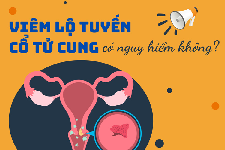 Bị viêm lộ tuyến 1cm là nặng hay nhẹ?