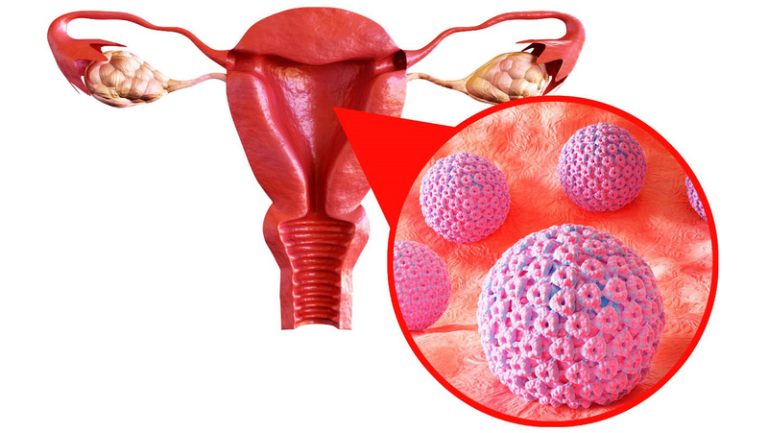 HPV là nguyên nhân gây ra các bệnh lý tình dục ở phụ nữ, liệu HPV có lây qua bồn cầu không ?