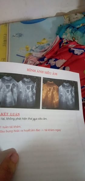 tử cung