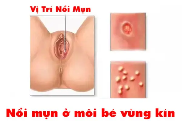 quan hệ