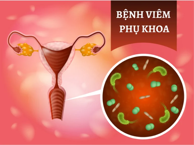 quan hệ