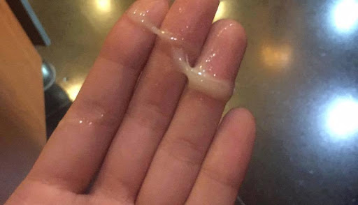 khí hư màu vàng