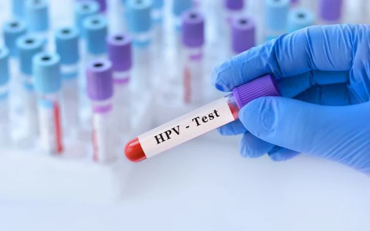 xét nghiệm HPV dương tính