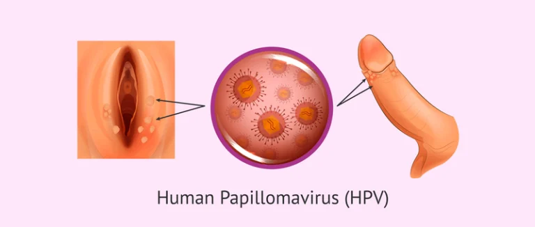 HPV