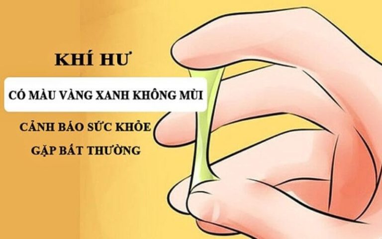 khí hư