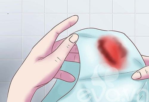 chảy máu bất thường vùng kín