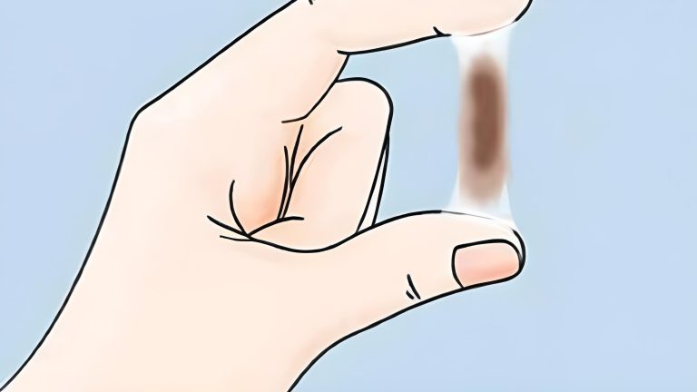 dịch nâu giữa chu kỳ kinh