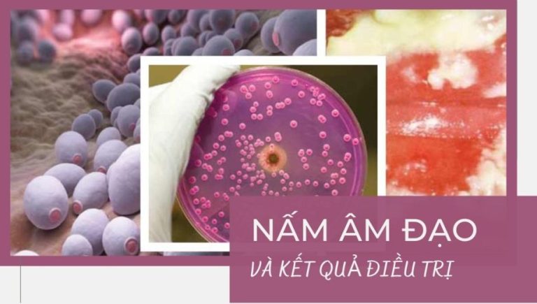 nấm âm đạo