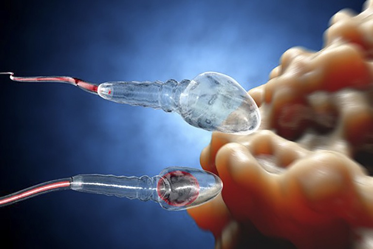 IUI
