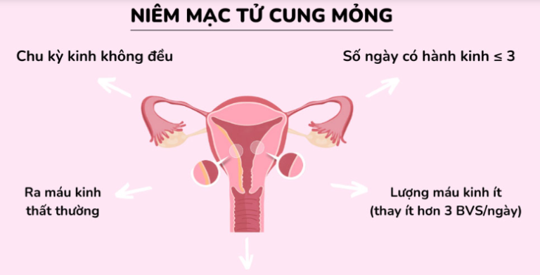 siêu âm