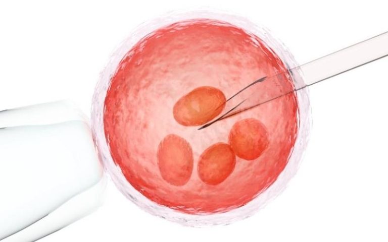 IUI