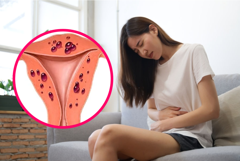 lạc nội mạc tử cung