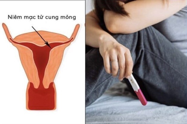 niêm mạc tử cung