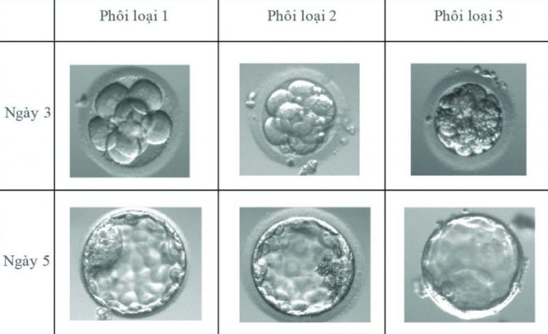 chuyển phôi