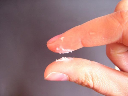 điều trị nấm