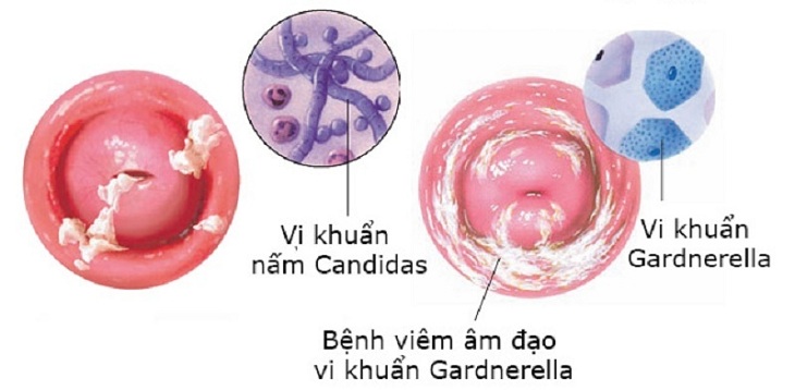 âm đạo