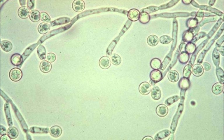 Nấm candida