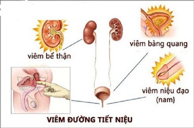 khám phụ khoa