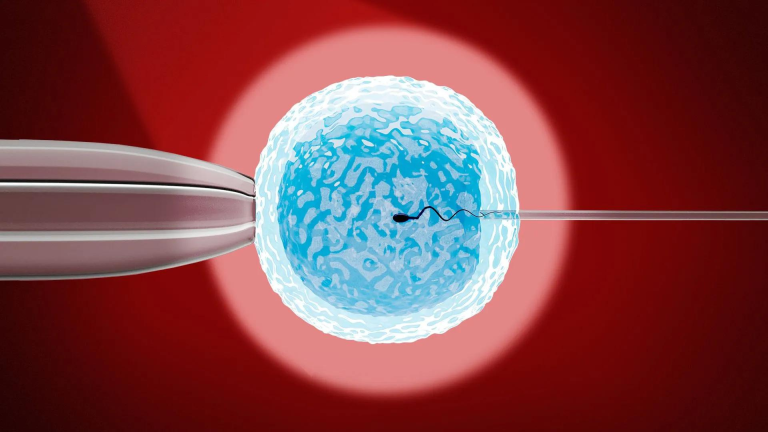 IVF