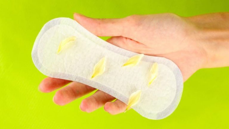khí hư bất thường