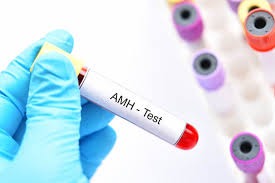 AMH