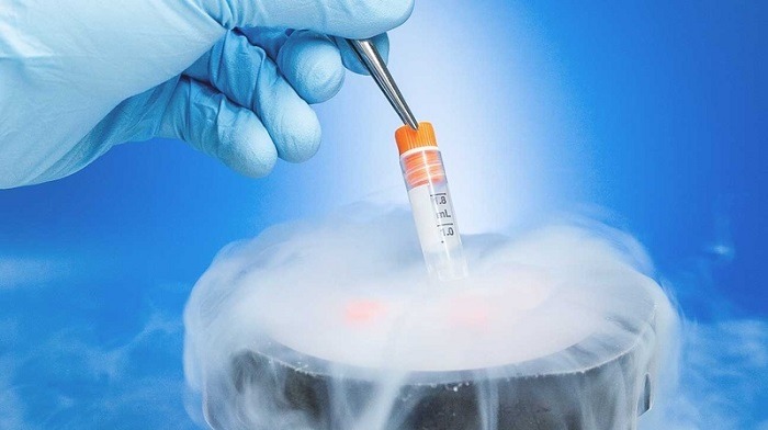 IVF
