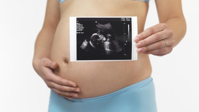 IVF